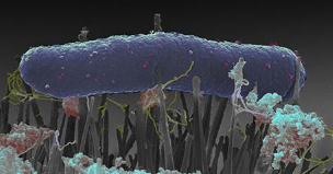 昆虫的翅膀可提供抗菌线索 从而改善医疗植入物