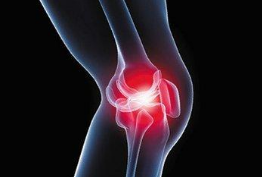 为什么膝关节骨关节炎患者会经历各种疼痛