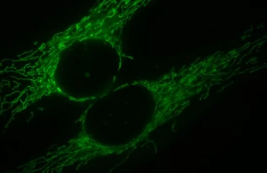 研究人员发现ALS起源的自食性线粒体