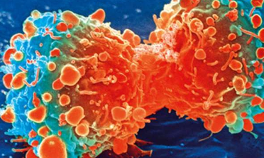 研究表明干扰素-γ如何指导对癌症免疫疗法的反应