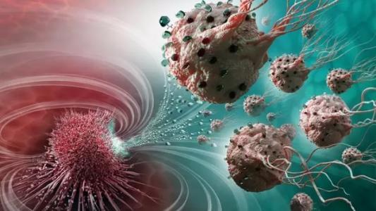 特拉维夫大学的研究人员通过超声波治疗破坏癌细胞