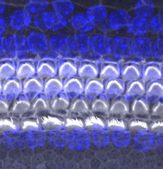 研究人员确定蛋白质在新的听力毛细胞发育中的作用