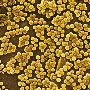 金黄色葡萄球菌是潜在危险的皮肤感染的主要原因