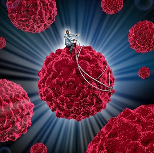 新型生物标志物预测免疫疗法对转移性乳腺癌的益处