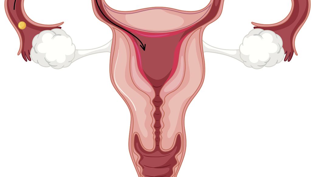 NIH资助的研究将子宫内膜异位症与DNA变化联系起来