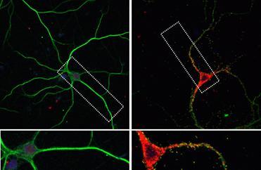 POSTECH研究小组已经确定了神经系统疾病的机制