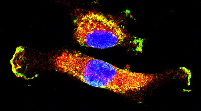 新研究揭示了对控制癌细胞生长的分子电路的新颖见解