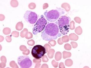 介绍下血细胞过氧化酶染色的临床意义