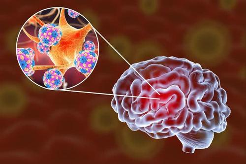 人体临床研究损伤和疾病引起的大脑炎症