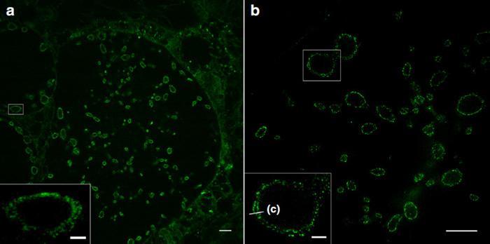 研究人员发现超高分辨率的细胞膜