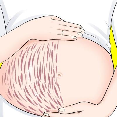 妊娠早期锰水平升高与先兆子痫风险降低有关