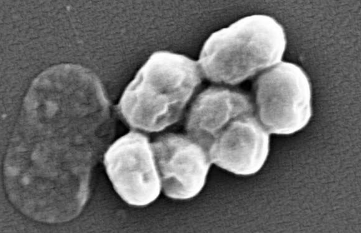 致命的超级细菌可能会重新使用抗生素