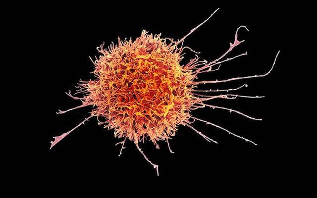 研究人员使用诱导性多能干细胞 创建了一种天然杀伤细胞