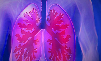 研究人员确定特定的基因和细胞途径是罕见的女性肺部疾病的关键因素