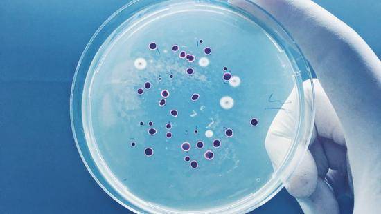 合理使用抗生素可以帮助抵抗细菌感染