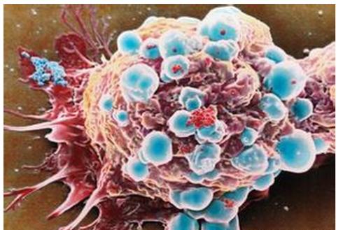 电磁场可能会阻碍乳腺癌细胞的扩散