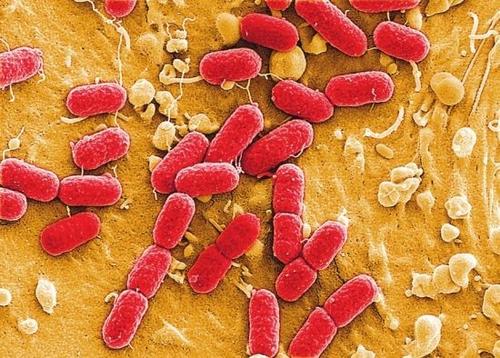 大肠杆菌如何知道如何引起最严重的感染
