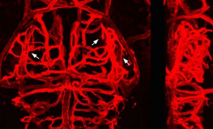 在发育过程中发现脑血管寻路的机制