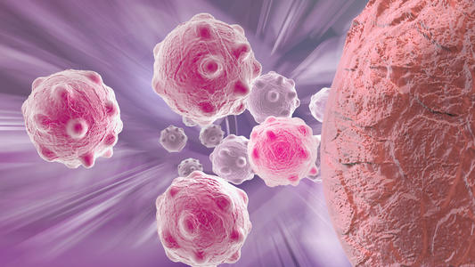 癌细胞改变蛋白质生产机制以加速转移
