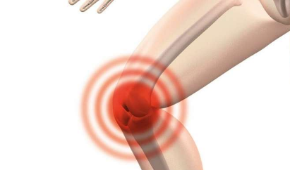 研究表明在进行膝盖和髋关节置换手术之前进行了不必要的压力测试