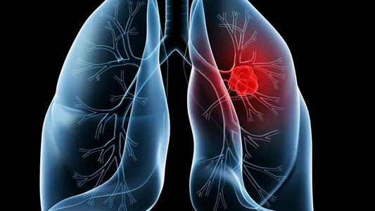 研究显示某些晚期肺癌患者的长期生存获益