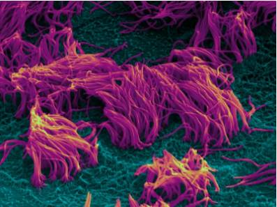 研究人员发现肺细胞对细菌的反应