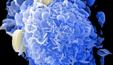 用CAR T细胞进行免疫疗法可让患者异常康复