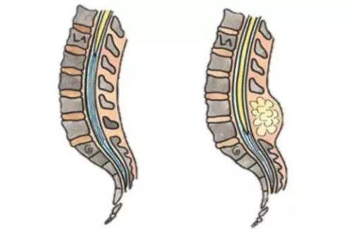 研究发现肠道如何与脊髓和大脑沟通