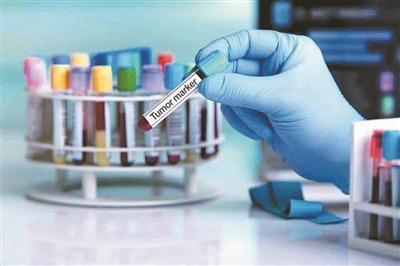 基于尿液的生物标志物用于癌症筛查测试