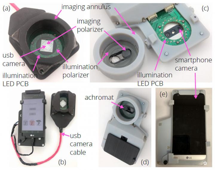 相机适配图像可检测黑色素瘤和非黑色素瘤
