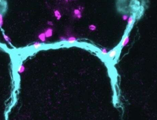 这些肌肉细胞是帮助再生扁虫长出眼睛的路标