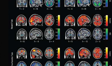 关于大脑活动的研究没有科学家认为的有用