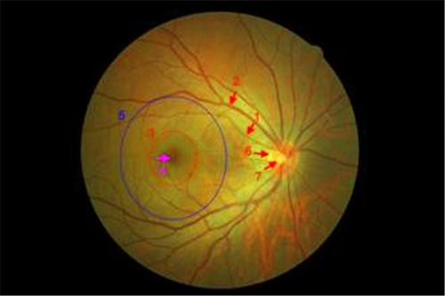 研究人员质疑色素性视网膜炎的机制