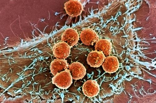 癌症中的多余染色体可能是好的也有可能是坏的