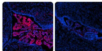 研究人员发现细胞可以处理错误折叠的蛋白质的新方法