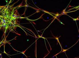 神经细胞如何控制错误折叠的蛋白质