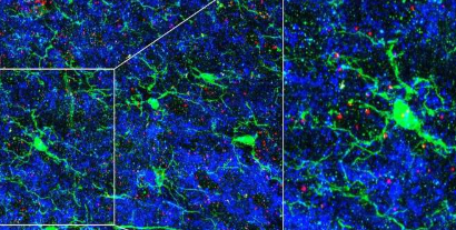 免疫细胞塑造大脑中的电路