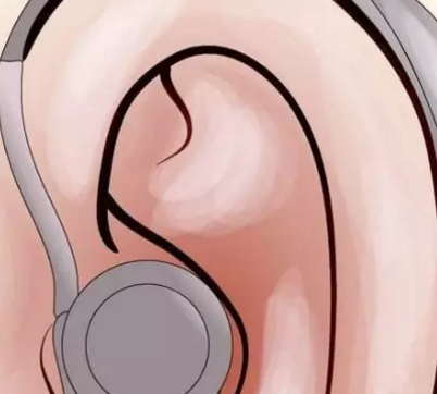 研究发现毛细胞丢失是与年龄相关的听力损失的根本原因