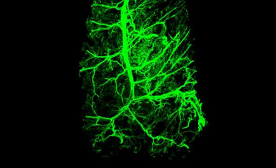 神经元如何重塑体内脂肪以提高其卡路里燃烧能力