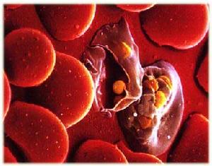 新研究揭示了复杂疟疾感染的根源