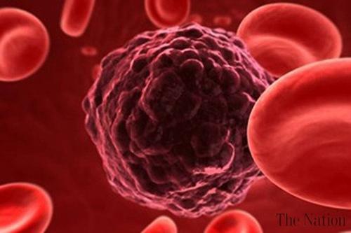 研究人员指出肿瘤相关蛋白减缓癌症进展