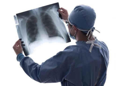 在肺癌手术中更频繁实施干预措施对治疗结果产生积极影响