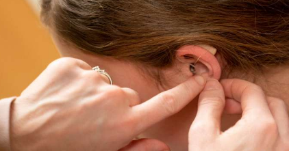 听力损失与儿童癌症幸存者的神经认知缺陷有关