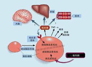 研究表明 更年期会增加代谢综合征的风险