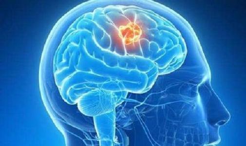 弗吉尼亚理工大学的科学家揭示脑肿瘤会影响正常有用的细胞