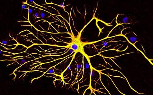 科学家发现大脑细胞从出生起就知道物体在重力作用下如何掉落