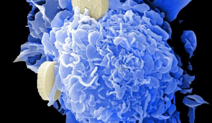 研究为细胞蛋白如何控制癌症扩散提供了新见解