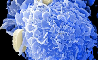 研究发现杀死癌细胞的脂肪酸