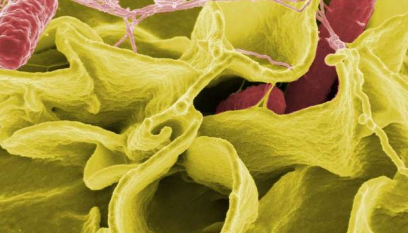 沙门氏菌感染期间淀粉样蛋白促进了反应性关节炎