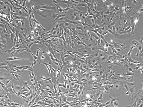星形胶质细胞保护神经元免受有毒物质的累积